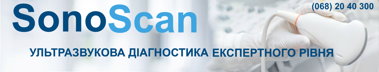 SONOSCAN – Центр  Ультразвукової  Діагностики