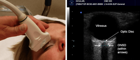 diagnostics-10-00085-g001